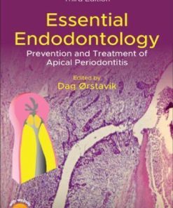 Essential Endodontology Prevention And Treatment Of Apical Periodontitis 3Rd