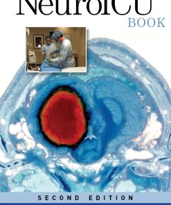 The NeuroICU Book 2nd 2E Kiwon Lee