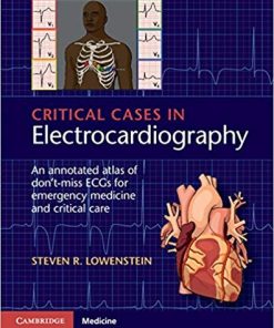 Critical Cases in Electrocardiography An Annotated Atlas