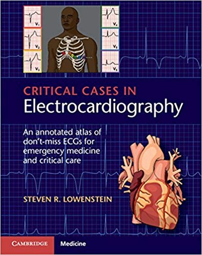 Critical Cases in Electrocardiography An Annotated Atlas