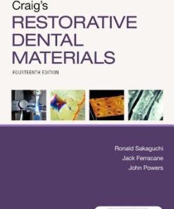 Craigs Restorative Dental Materials 14Th