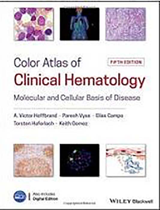Color Atlas of Clinical Hematology 5th 5E A Hoffbrand