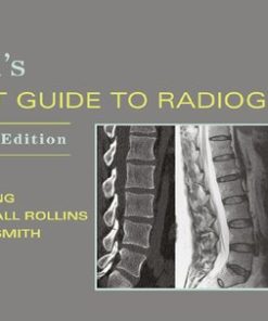 Merrill8217s pocket guide to radiography