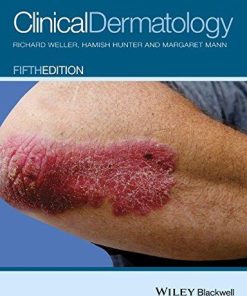 Clinical Dermatology 5Th