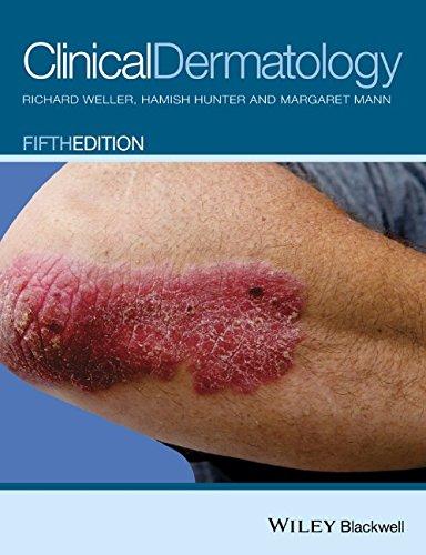 Clinical Dermatology 5Th