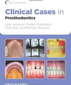 Clinical Cases In Prosthodontics