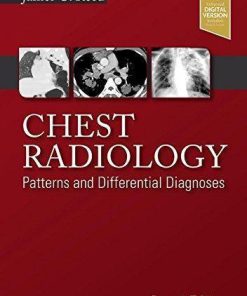 Chest Radiology Patterns And Differential Diagnoses 7Th