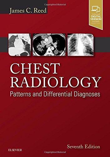 Chest Radiology Patterns And Differential Diagnoses 7Th