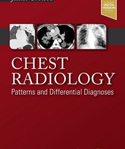 Chest Radiology Patterns and Differential Diagnoses