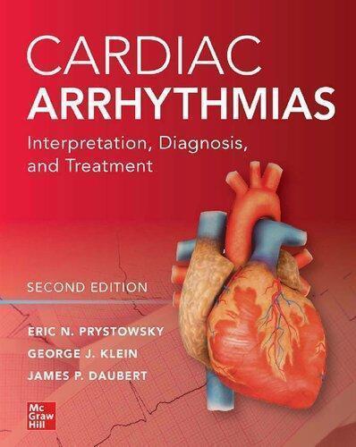Cardiac Arrhythmias Interpretation Diagnosis And Treatment 2Nd