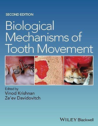 Biological Mechanisms Of Tooth Movement 2Nd