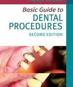 Basic Guide To Dental Procedures 2Nd