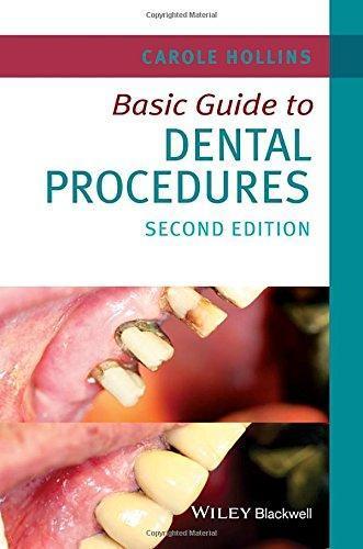 Basic Guide To Dental Procedures 2Nd