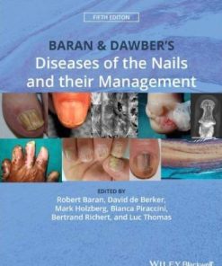 Baran Dawbers Diseases Of The Nails And Their Management 5Th