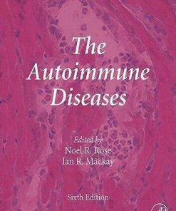 The Autoimmune Diseases 6Th