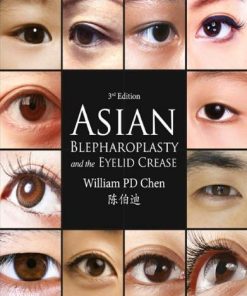 Asian Blepharoplasty And The Eyelid Crease 3Rd