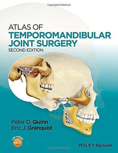 Atlas Of Temporomandibular Joint Surgery 2Nd