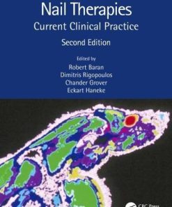 Nail Therapies Current Clinical Practice 2Nd