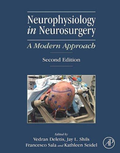 Neurophysiology In Neurosurgery A Modern Approach 2Nd