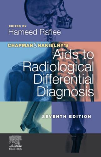 Chapman Nakielnys Aids To Radiological Differential Diagnosis 7Th