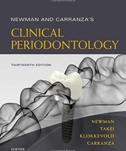 Newman And Carranzas Clinical Periodontology 13Th