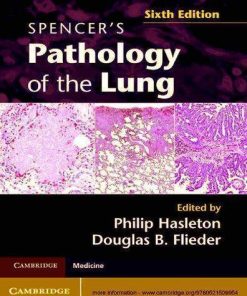 Spencers Pathology Of The Lung 6Th