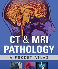 CT ampamp MRI Pathology A Pocket Atlas Third