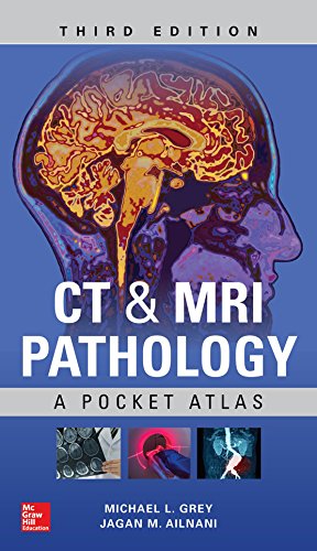 CT ampamp MRI Pathology A Pocket Atlas Third
