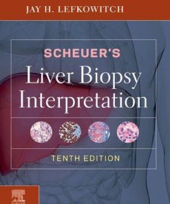 Scheuers Liver Biopsy Interpretation 10Th