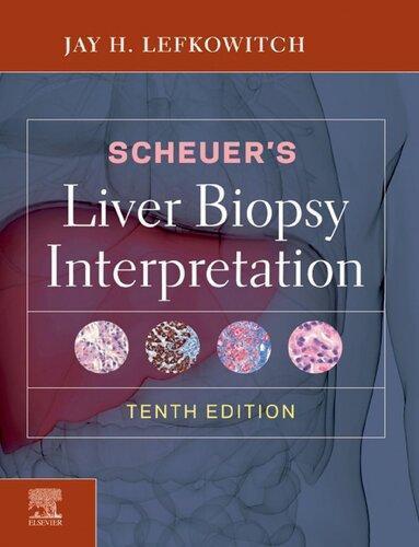 Scheuers Liver Biopsy Interpretation 10Th