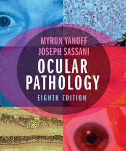 Ocular Pathology 8Th