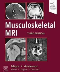 Musculoskeletal Mri 3Rd