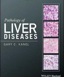 Pathology Of Liver Diseases