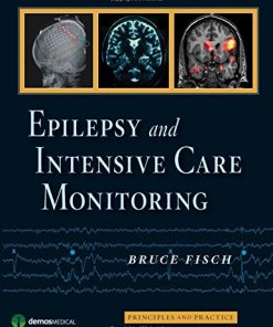 Epilepsy and Intensive Care Monitoring Principles and Practice