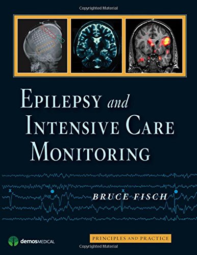 Epilepsy and Intensive Care Monitoring Principles and Practice