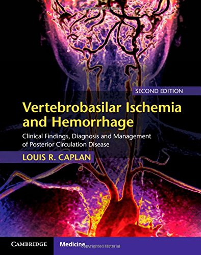 Vertebrobasilar Ischemia and Hemorrhage Clinical Findings Diagnosis and Management of Posterior Circulation Disease 2