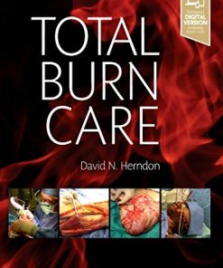 Total Burn Care