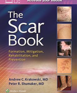 The Scar Book Formation Mitigation Rehabilitation and Prevention 1st