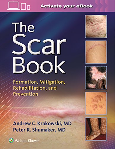 The Scar Book Formation Mitigation Rehabilitation and Prevention 1st