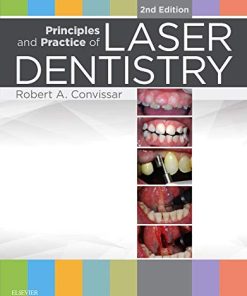 Principles and Practice of Laser Dentistry 2e 8211 2nd