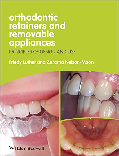 Orthodontic Retainers and Removable Appliances Principles of Design and Use 8211 1st