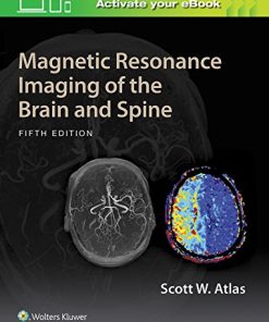 Magnetic Resonance Imaging of the Brain and Spine