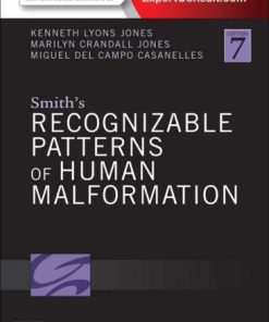 Smiths Recognizable Patterns Of Human Malformation 7Th