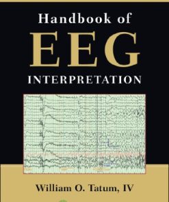 Handbook of EEG Interpretation 8211 2nd