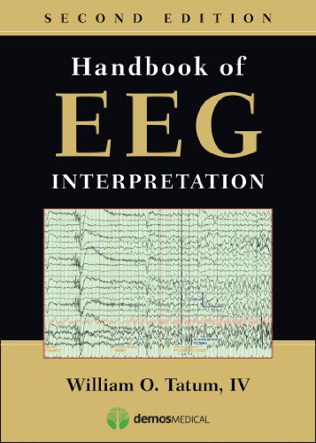 Handbook of EEG Interpretation 8211 2nd