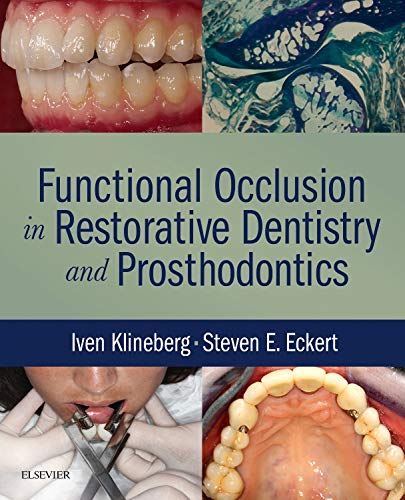 Functional Occlusion in Restorative Dentistry and Prosthodontics 1e
