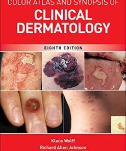 Fitzpatricks Color Atlas and Synopsis of Clinical Dermatology 8211 8th