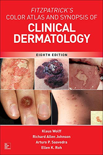 Fitzpatricks Color Atlas and Synopsis of Clinical Dermatology 8211 8th