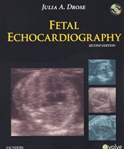 Fetal Echocardiography