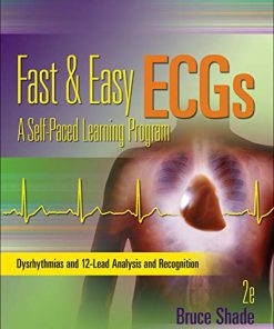 Fast 038 easy ECGs a selfpaced learning program 8211 2nd